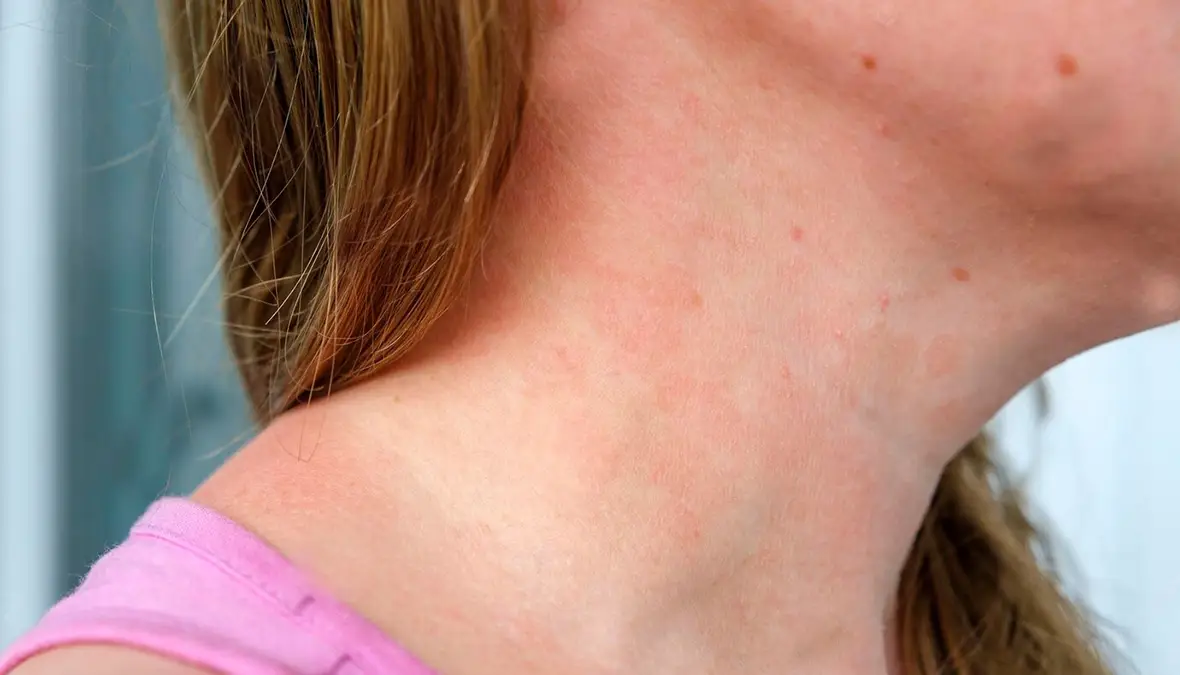 theodoros-kafasis-genikos-oikogeneiakos-iatros-dermatitida